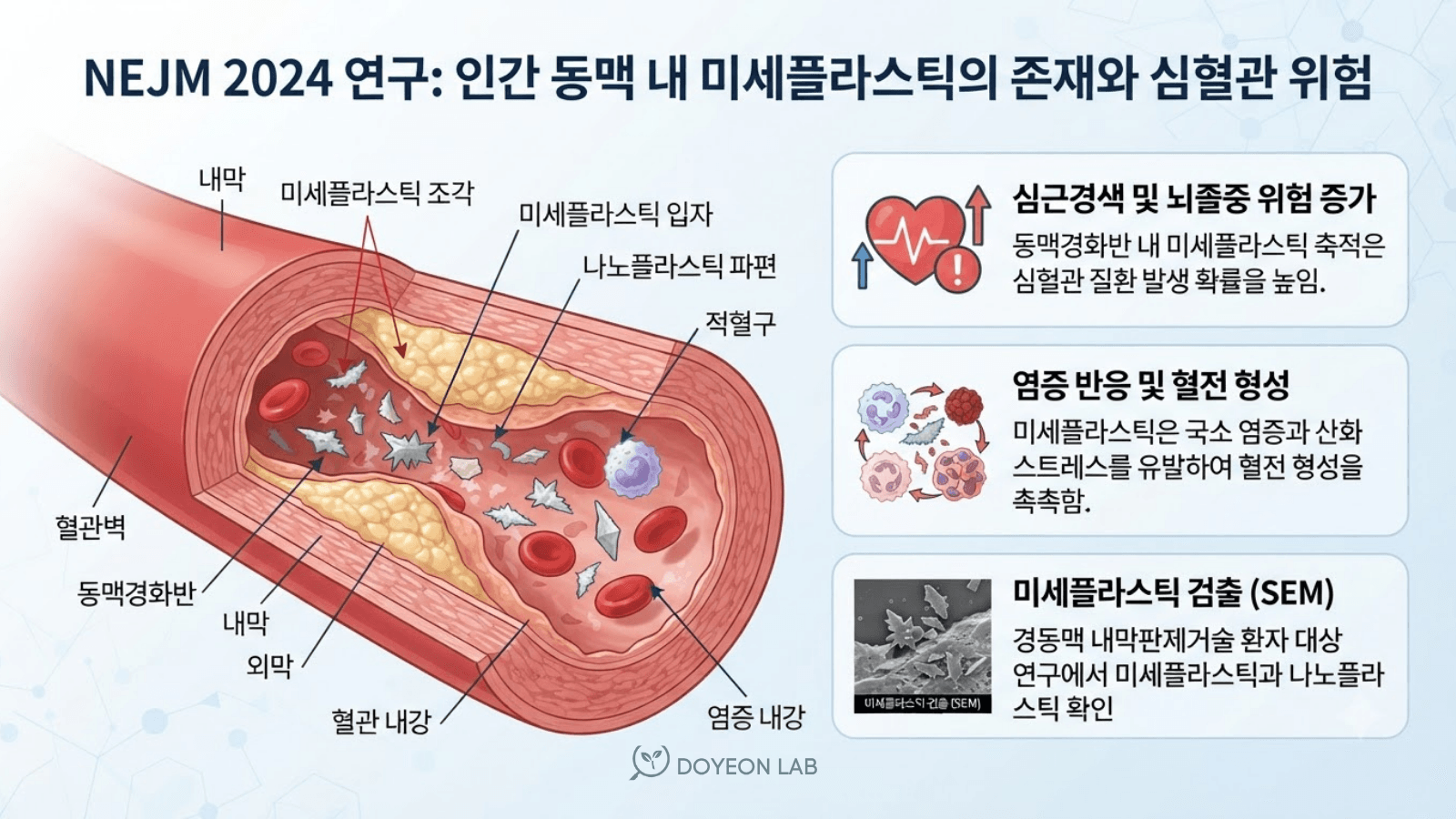 NEJM 연구 요약 일러스트